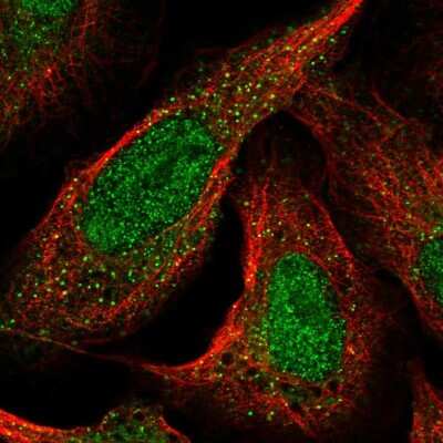 Immunocytochemistry/ Immunofluorescence: CDKL1 Antibody [NBP2-57291]