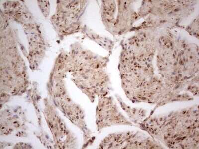 Immunohistochemistry: CDKL1 Antibody (OTI1D9) - Azide and BSA Free [NBP2-71389]