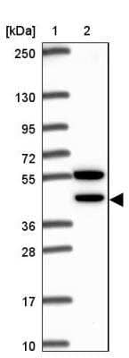 Western Blot: CDKL1 Antibody [NBP2-32482]