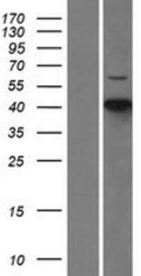 Western Blot: CDKL1 Overexpression Lysate [NBL1-09047]