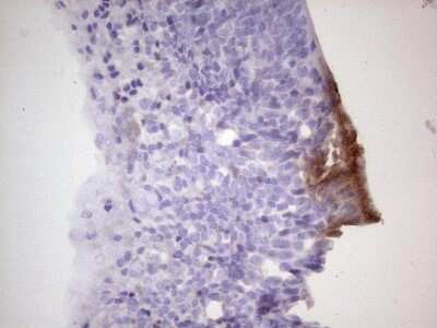 Immunohistochemistry: CDKL2 Antibody (OTI12C2) [NBP2-46218]