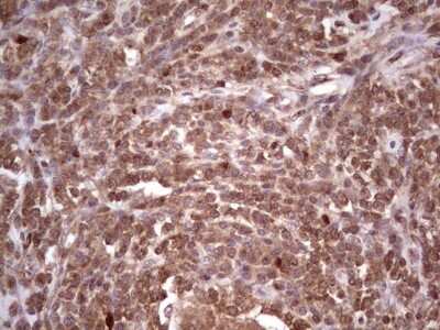 Immunohistochemistry: CDKL2 Antibody (OTI12C2) [NBP2-46218]