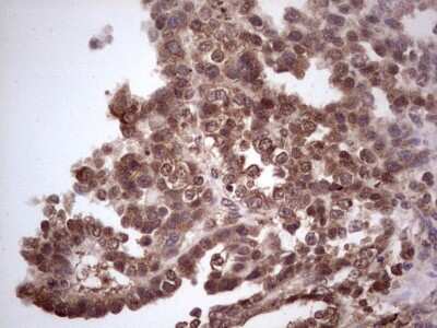 Immunohistochemistry: CDKL2 Antibody (OTI12C2) [NBP2-46218]