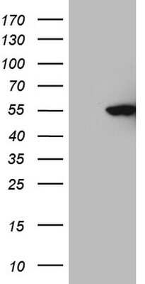 Western Blot: CDKL2 Antibody (OTI12C2) [NBP2-46218]