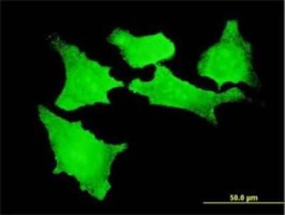 Immunocytochemistry/ Immunofluorescence: CDKL2 Antibody (1F6) [H00008999-M01]