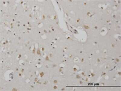 Immunohistochemistry-Paraffin: CDKL2 Antibody (1F6) [H00008999-M01]
