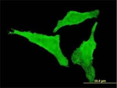 Immunocytochemistry/ Immunofluorescence: CDKL2 Antibody (6H8) [H00008999-M02]