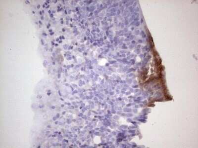 Immunohistochemistry: CDKL2 Antibody (OTI12C2) - Azide and BSA Free [NBP2-71406]