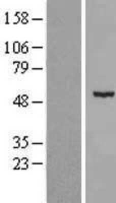 Western Blot: CDKL2 Overexpression Lysate [NBL1-09048]