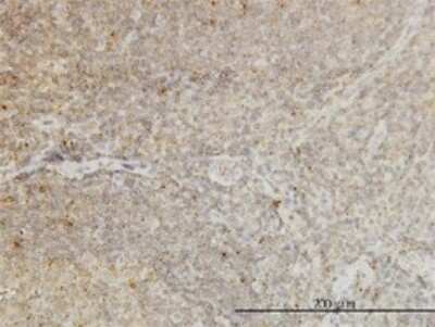 Immunohistochemistry-Paraffin: CDKL4 Antibody (5G3) [H00344387-M01]