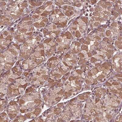 Immunohistochemistry: CDKL4 Antibody [NBP2-39090]