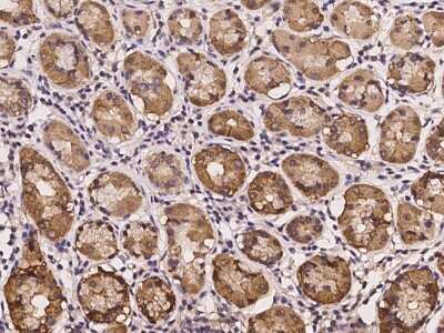 Immunohistochemistry-Paraffin: CDKL4 Antibody [NBP2-97193]