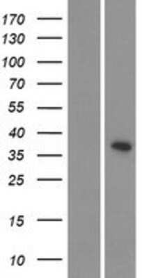 Western Blot: CDKL4 Overexpression Lysate [NBP2-08705]