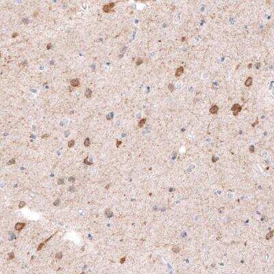 Immunohistochemistry: CDKL5 Antibody (CL4881) [NBP2-61145]