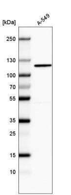 Western Blot: CDKL5 Antibody (CL4881) [NBP2-61145]