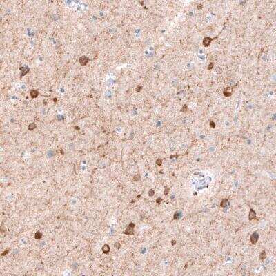 Immunohistochemistry: CDKL5 Antibody (CL4888) [NBP2-61146]