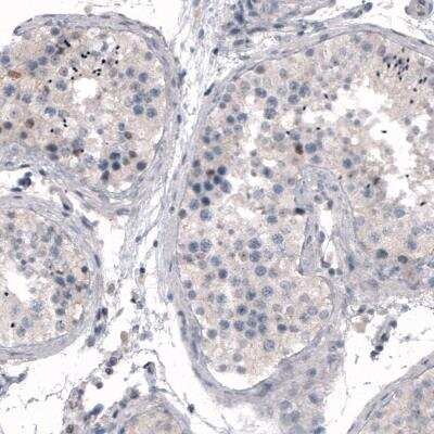 Immunohistochemistry: CDKL5 Antibody (CL4888) [NBP2-61146]