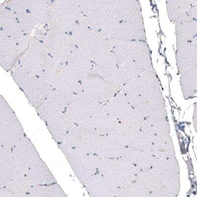 Immunohistochemistry: CDKL5 Antibody (CL4888) [NBP2-61146]