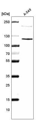 Western Blot: CDKL5 Antibody (CL4888) [NBP2-61146]