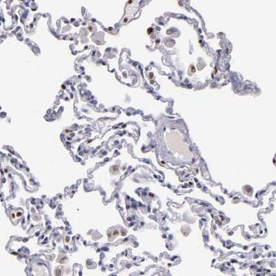 Immunohistochemistry-Paraffin: CDKL5 Antibody [NBP1-84881]