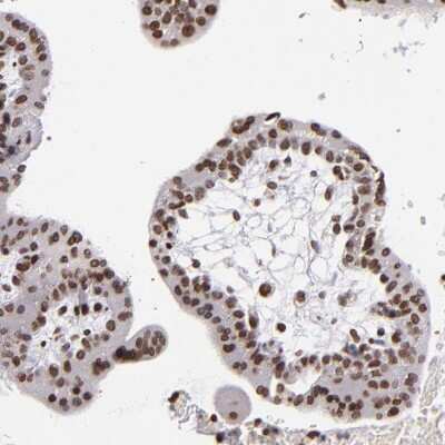 Immunohistochemistry-Paraffin: CDKL5 Antibody [NBP1-84881]
