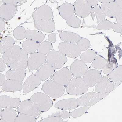 Immunohistochemistry-Paraffin: CDKL5 Antibody [NBP1-84881]