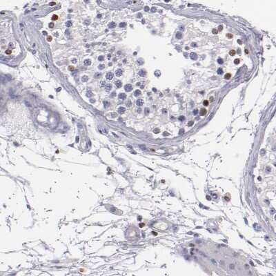 Immunohistochemistry-Paraffin: CDKL5 Antibody [NBP1-84881]