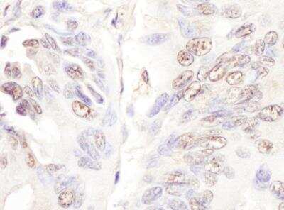 Immunohistochemistry-Paraffin: CDKL5 Antibody [NBP2-32157]