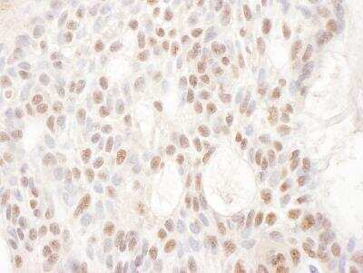 Immunohistochemistry-Paraffin: CDKL5 Antibody [NBP2-32157]