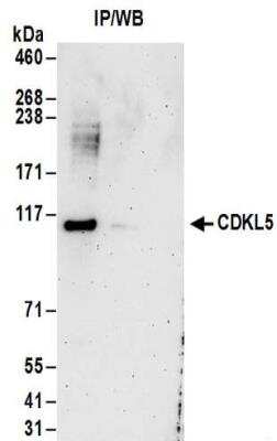 Immunoprecipitation: CDKL5 Antibody [NBP2-32157]