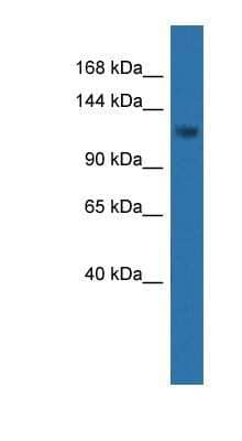 Western Blot: CDKL5 Antibody [NBP1-79782]