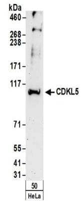 Western Blot: CDKL5 Antibody [NBP2-32157]