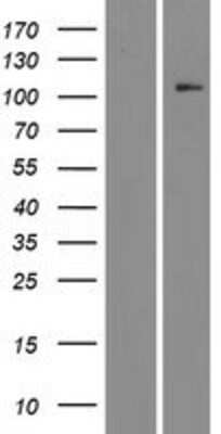 Western Blot: CDKL5 Overexpression Lysate [NBP2-08547]