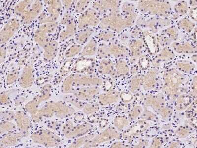 Immunohistochemistry-Paraffin: CDKN2A Interacting protein N-Terminal Like Antibody [NBP2-97396]