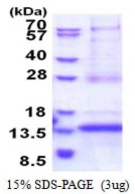 SDS-PAGE: Recombinant Human CDKN2A Interacting protein N-Terminal Like His Protein [NBP2-51567]