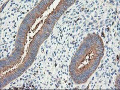 Immunohistochemistry-Paraffin: CDKN3 Antibody (OTI2E11) [NBP2-01245]