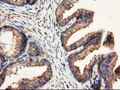 Immunohistochemistry-Paraffin: CDKN3 Antibody (OTI2E11) [NBP2-01245]