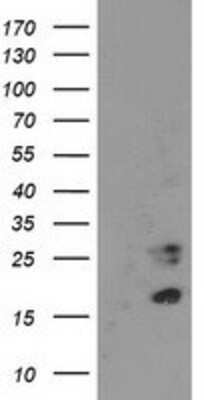 Western Blot: CDKN3 Antibody (OTI2E11) [NBP2-01245]