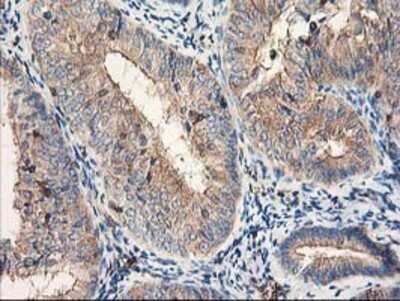 Immunohistochemistry: CDKN3 Antibody (OTI2E11) - Azide and BSA Free [NBP2-70399]