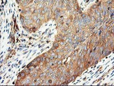 Immunohistochemistry: CDKN3 Antibody (OTI2E11) - Azide and BSA Free [NBP2-70399]