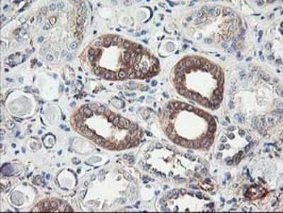Immunohistochemistry: CDKN3 Antibody (OTI2E11) - Azide and BSA Free [NBP2-70399]