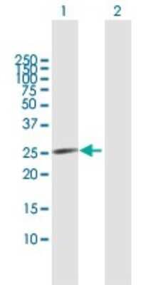 Western Blot: CDKN3 Antibody [H00001033-B02P]