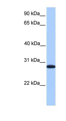 Western Blot: CDKN3 Antibody [NBP1-58079]