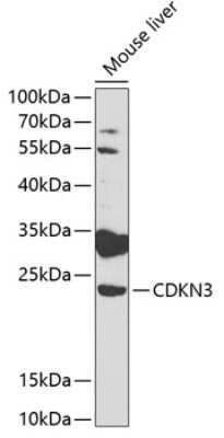 Western Blot: CDKN3 AntibodyAzide and BSA Free [NBP2-92881]