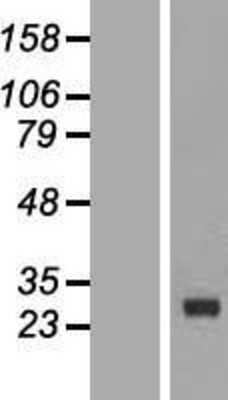 Western Blot: CDKN3 Overexpression Lysate [NBP2-07781]