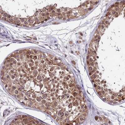Immunohistochemistry-Paraffin: CDNF Antibody [NBP1-88994]