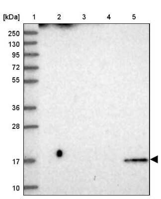 Western Blot: CDNF Antibody [NBP1-88994]