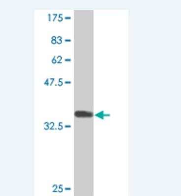 Western Blot: CDO Antibody (2G12) [H00050937-M03]