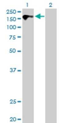 Western Blot: CDO Antibody [H00050937-B01P]