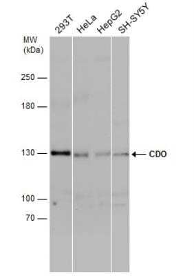 Western Blot: CDO Antibody [NBP2-15849]